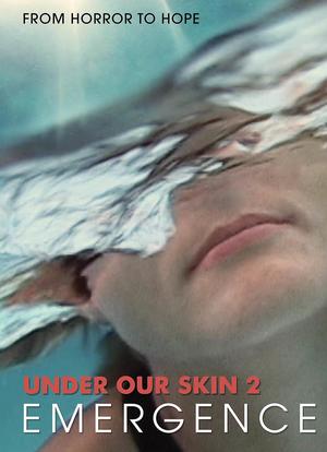 Under Our Skin 2: Emergence海报封面图