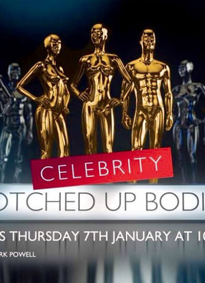 Celebrity Botched Up Bodies海报封面图