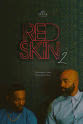 Chris Saunders Red Skin