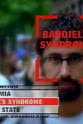 Alan Cowan Baddiel's Syndrome