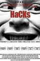 Glenn Rockowitz Hacks