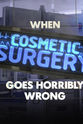 丹妮尔·洛伊德 When Plastic Surgery Goes Horribly Wrong
