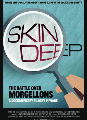 Skin Deep: The Battle Over Morgellons海报封面图