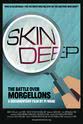 Shelby Hadden Skin Deep: The Battle Over Morgellons